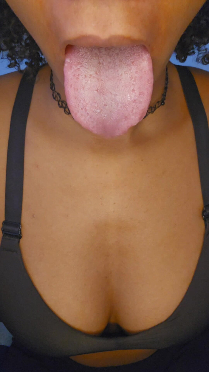 Bunnii: Tongue stuzzicamento: Solo per te