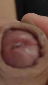 Amazing Pre Cum Glans.