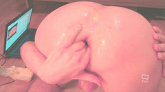 dolphinboy: Dubur melampau - pancutan dubur berair