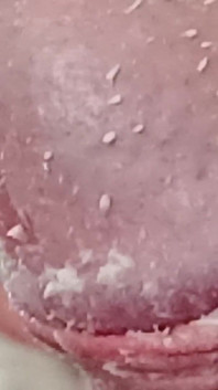 Smegma Foreskin Roll. bigpisser