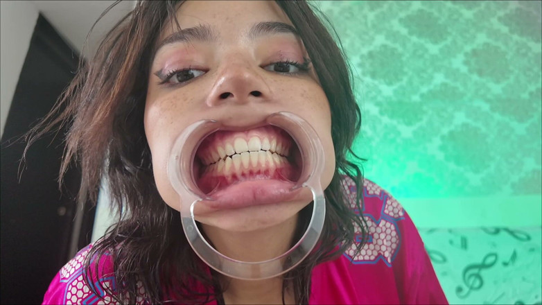 KiyuSweetCrazy: Cheeks Pulled Apart Teeth Exposed