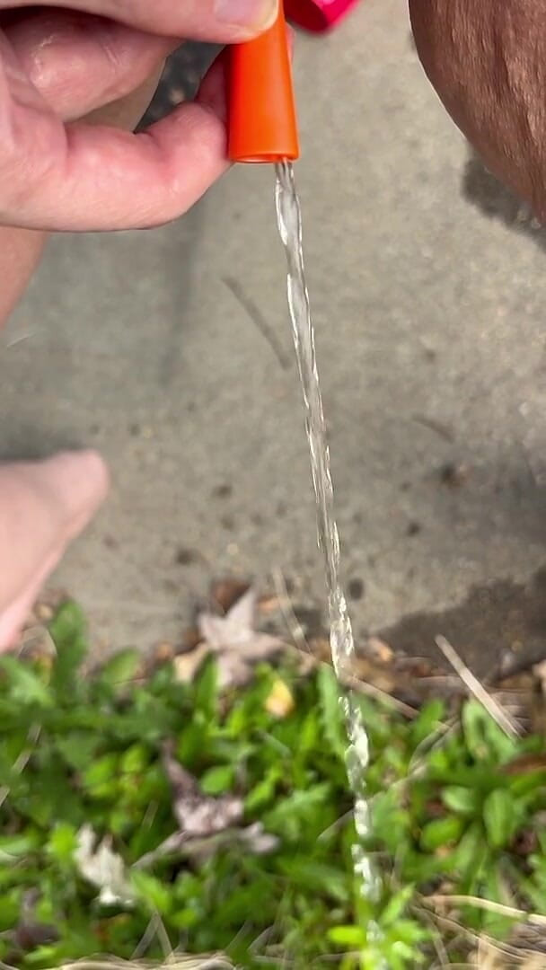 Peeing Through Catheter Outside (Hot potato girl) Peeing Through Catheter Outside (Hot potato girl)