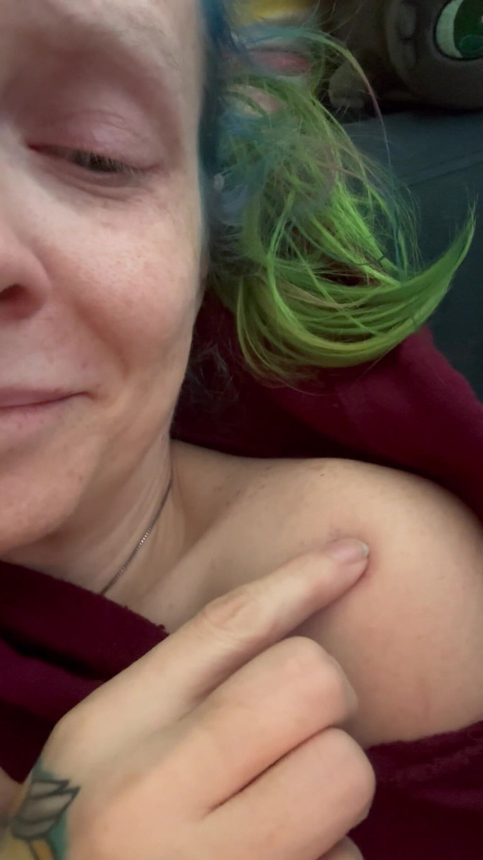 Hot potato girl: Pushing on My Bruise Cuz He’d Like It