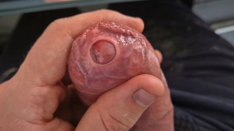 GloomyChase977: Grande papai sem cortes .. Apertada Phimosis Foreskin Play, Precum Flood...