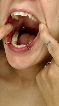 Visite de la grosse bouche avec piercings