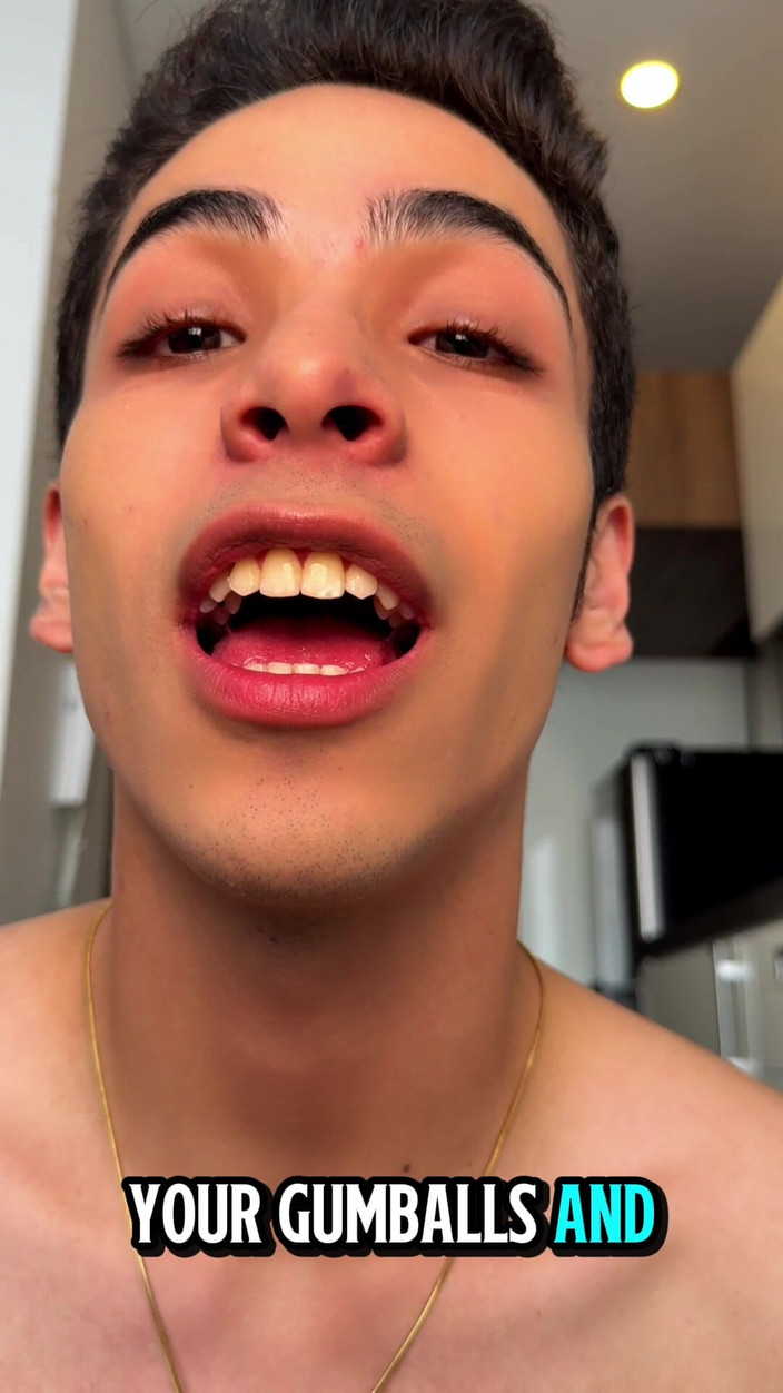 aodaboy: Aparelhos do lado de fora e precisamos comemorar