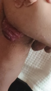 Prolapse and Urine