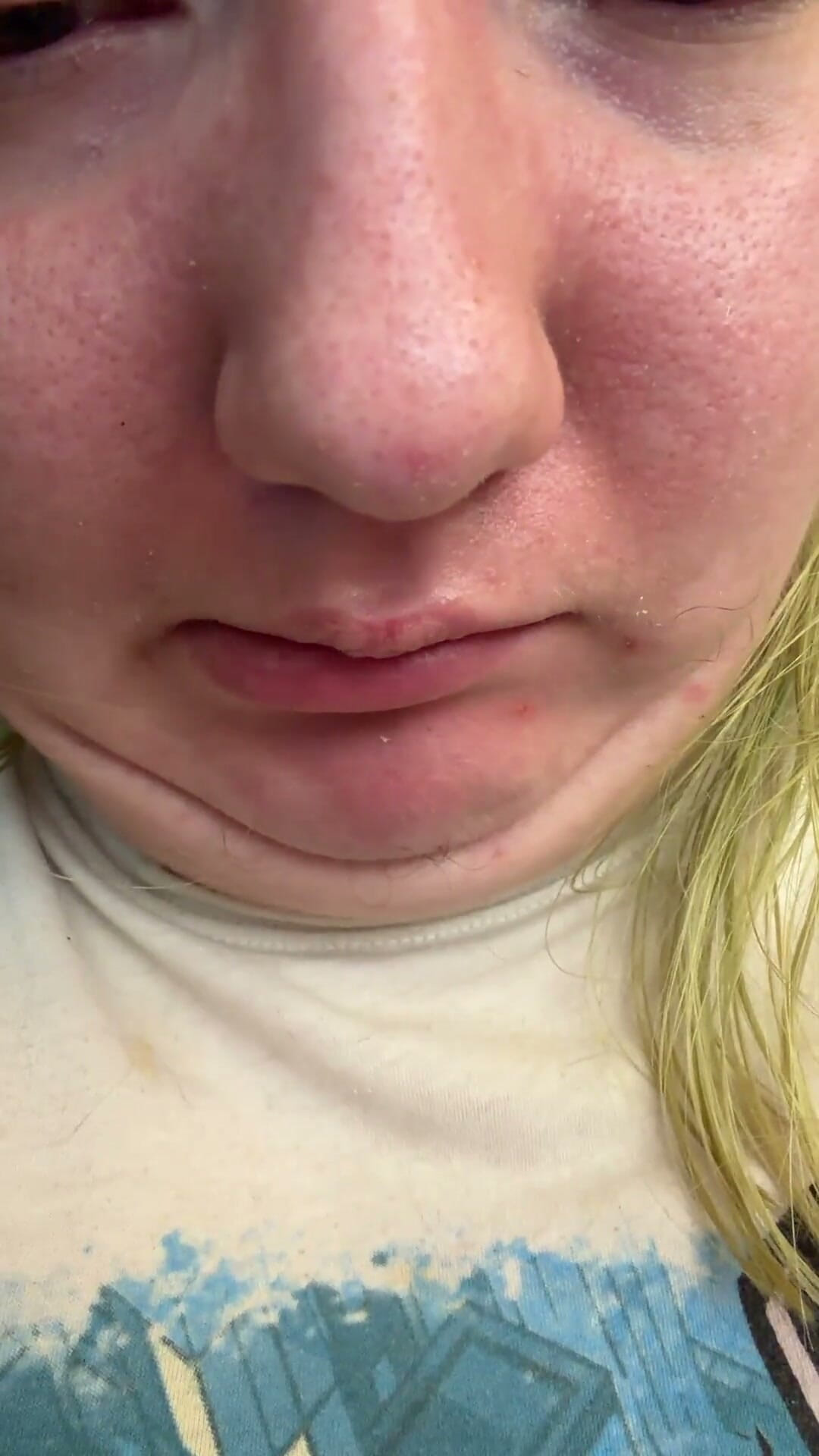 Chin Faces