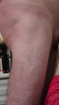 Guy with Ed and Peyronies Still Gets to Cum Over His Wife's Face