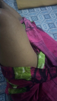 Hot Leg