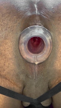 Ass Gape