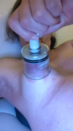 Alexia_mtf: 나를 자극하는 상처