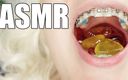 Arya Grander: Niềng răng tôn sùng asmr video mukbang
