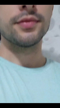 Nipples