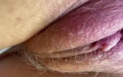 Guys, Tell Me Honestly! Fake or Natural Tits?! Should I Have a Breast Augmentation?