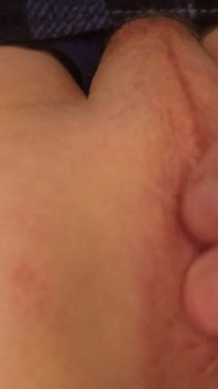 A Young Nerd's Dilated Anus!