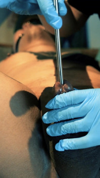 Kink : un homme dans la douleur, un fantasme de medfet hardcore