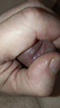 Is My Meatus Open?