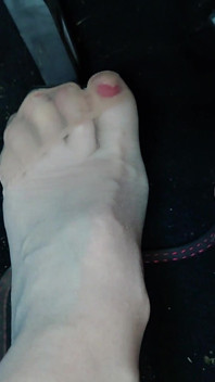 Pompage de pédales dans Birkenstocks