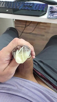 Condom Filled with Semen