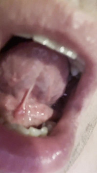 Mad for Tongue