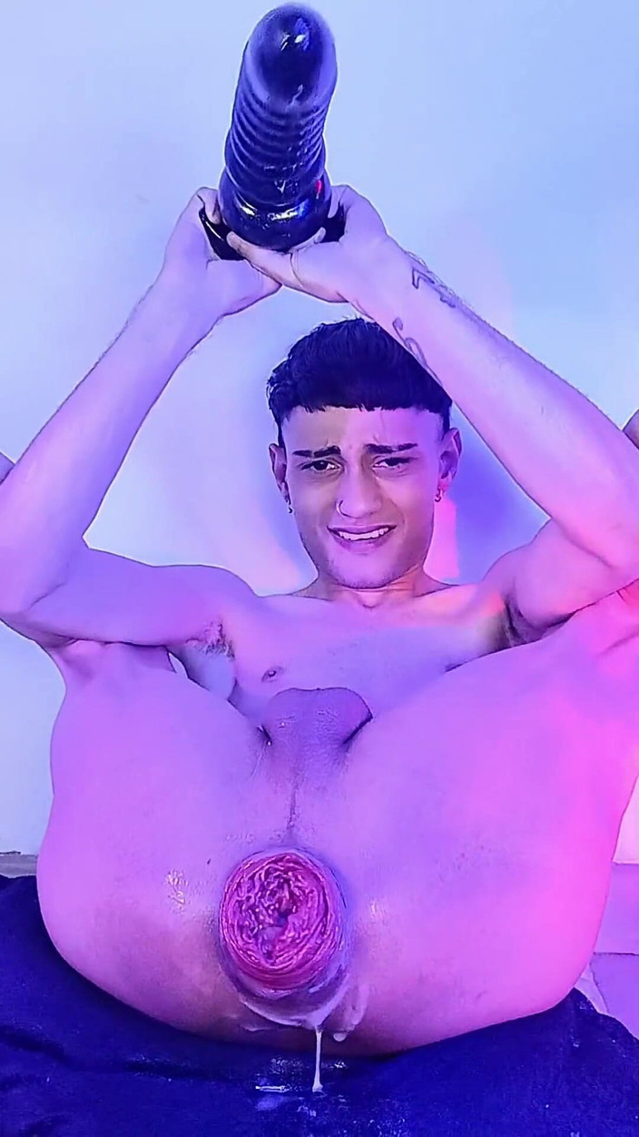 Anders: Eu Gosto Das Arbolas No Meu Traseiro