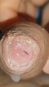 Grande Queijo Acumulado Em Close up Da Glande.