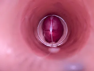 Vrouwelijke inseminatie - interne camera legt diepe mannelijke ejaculatie vast