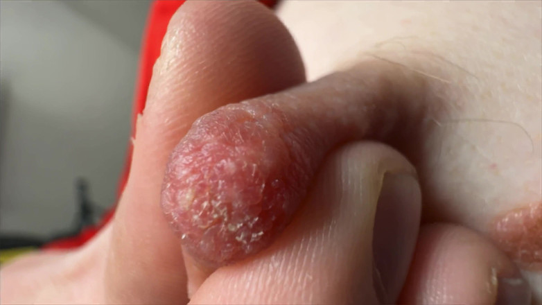 Skinny_lady69: Bradavky Super zblízka