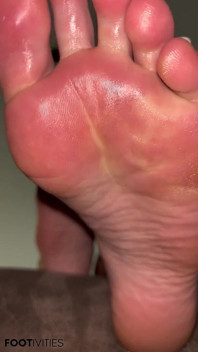En Primer Plano Facial De Pies Sudorosos Por Los Pies De Ivy