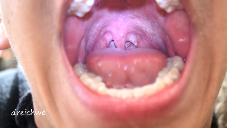 Dreichwe: Uvula, fétiche de la bouche