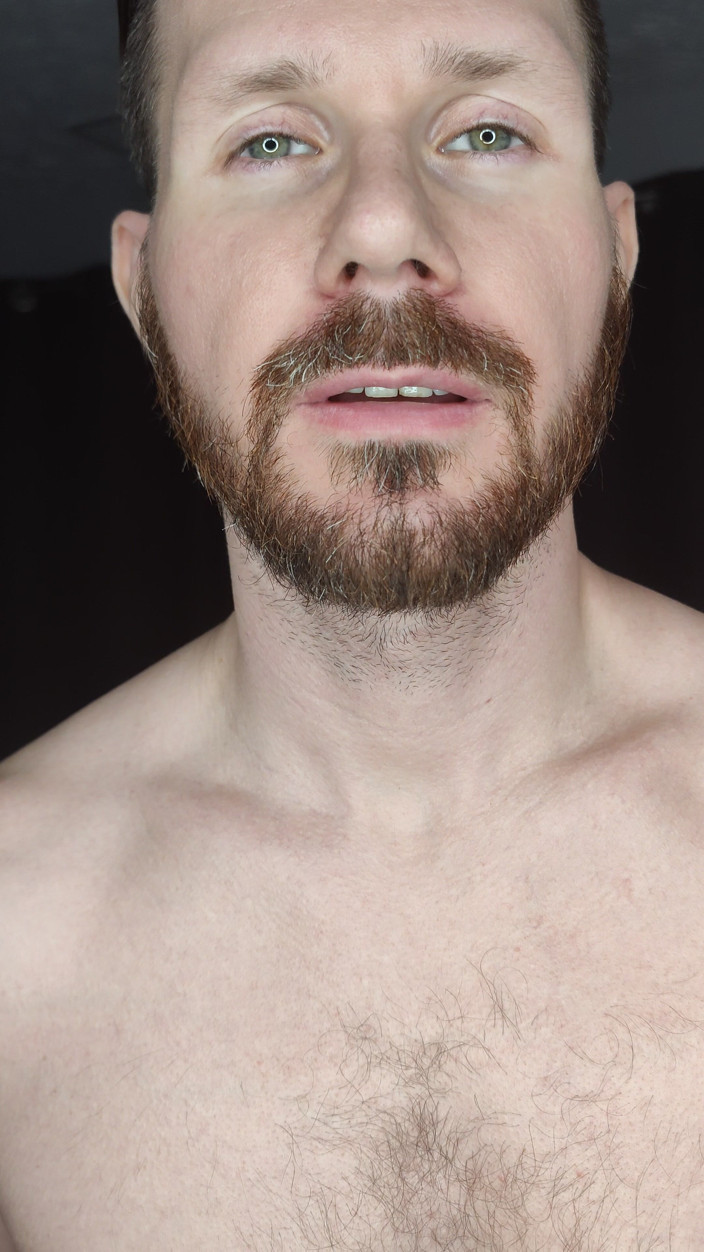 Albino Adonis: Benvenuto