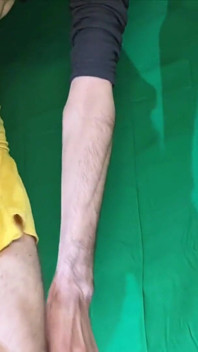 Pale Yellow Thong Under Yellow Skirt