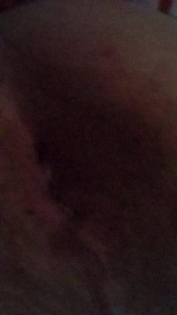 Pulse Ass