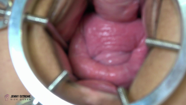 Jenny Extreme: Altre Esplorazioni Fisting
