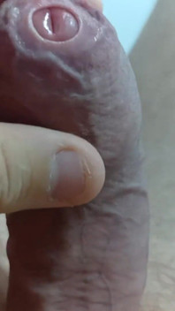 Big Uncut Tight Forskin Cock - Phimosis, Short Cock Play