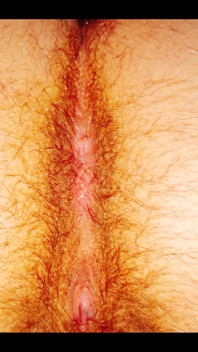 A Butt That Hairy
