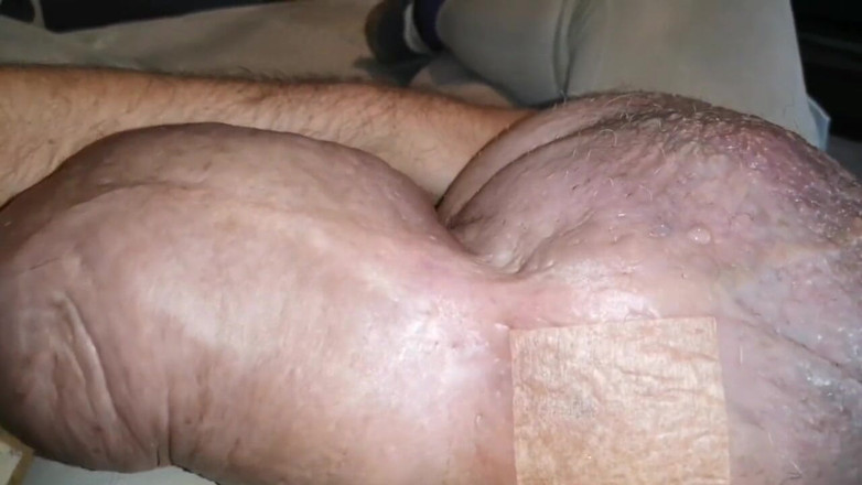 Monster_Meat_: Swollen obscene filled silicone filled meat