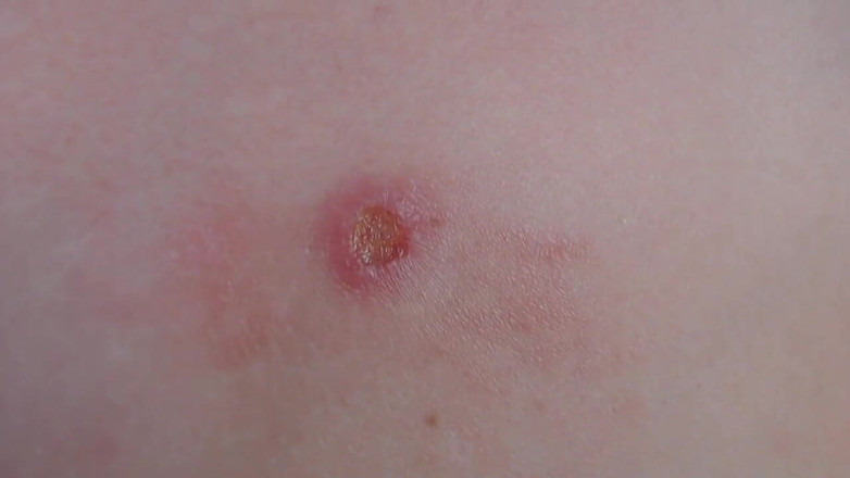 Miodelka: Mes seins flasques ont servi de cendrier et montrant à quoi...
