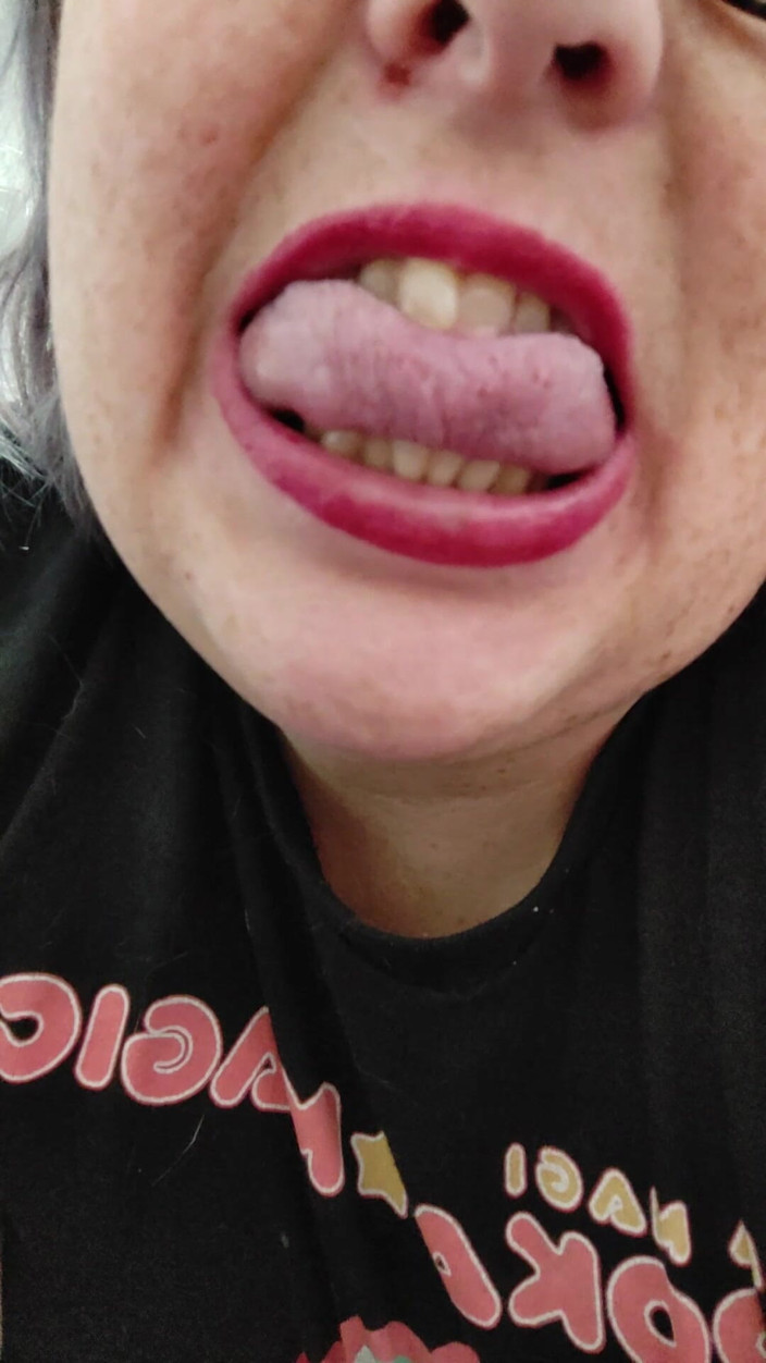 AngYourDirtyCanadian: Close up of My Mouth and Tongue