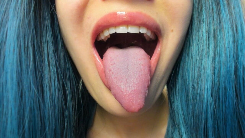 Rarible Diamond: Drool nhỏ giọt từ lưỡi của tôi