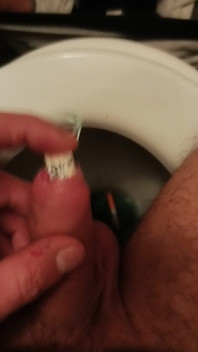 Mein Einführen Eines Tampons in Die Harnröhre Des Penis