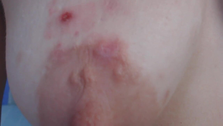 Miodelka: My saggy tits served as an ashtray and Showing how...