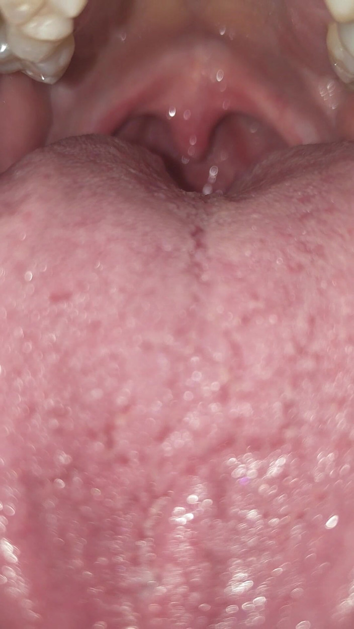 AngYourDirtyCanadian: Uvula Tachinare: prim-plan oral extrem