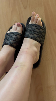 Feet in Flip-flops