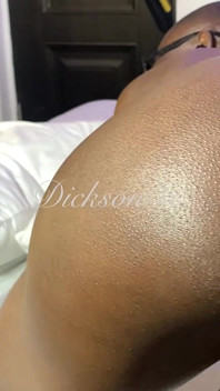 Dickson