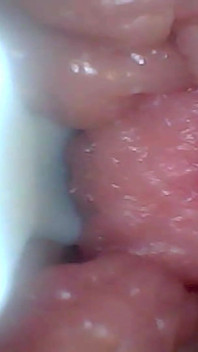 Endoskopová kamera ukazuje nejcitlivější části vzdělávacího videa penisu