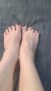 Do We See How Beguiled My Throbbing Foot Veins Are