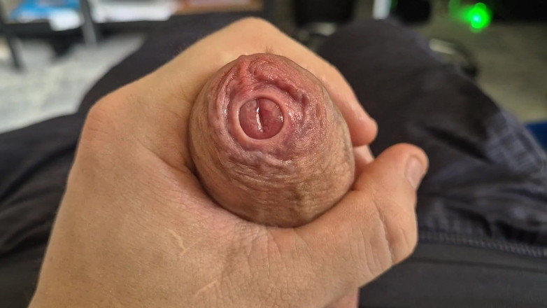 GloomyChase977: Apretada polla de Phimosis sin cortar estirada de cerca Juego...