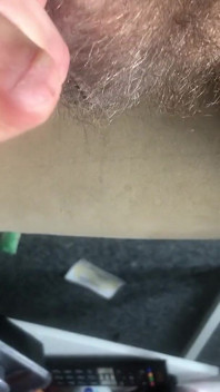Spermaxl